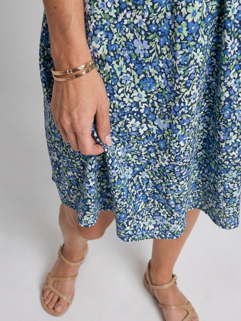 Blue tropical print dress with elastic waist and gathered knee-length skirt